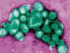 H1N1-Virus : Zwei Schweinegrippe-Tote (3, 51) in Göttingen - News - Bild.de