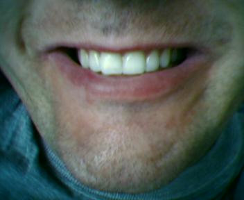 Hot Stock Ignore Liste 60283