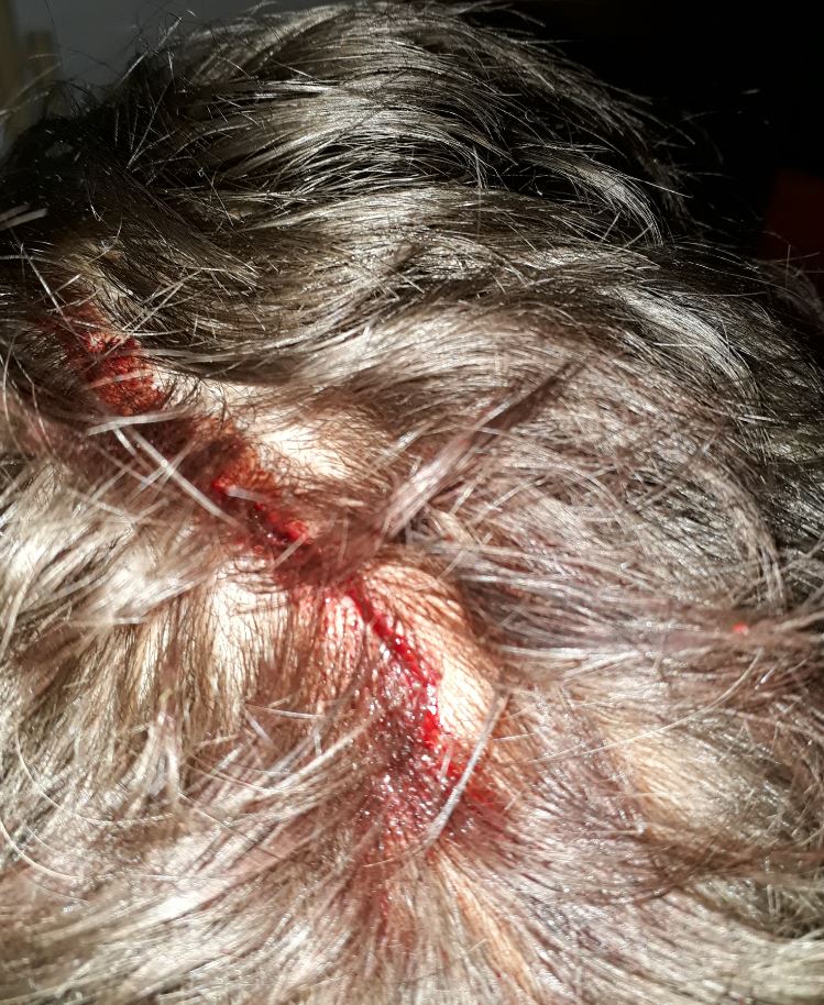 2020 QV-GDAXi-DJ-GOLD-EURUSD-JPY 1160854