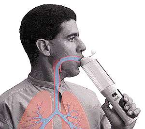 Pfizer - zu Unrecht im Keller 110324