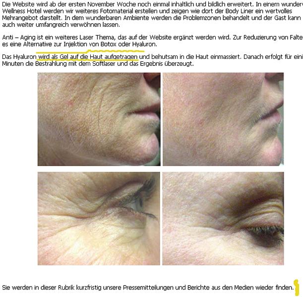 Injex AG - Wahrheit und Träumerei 573774