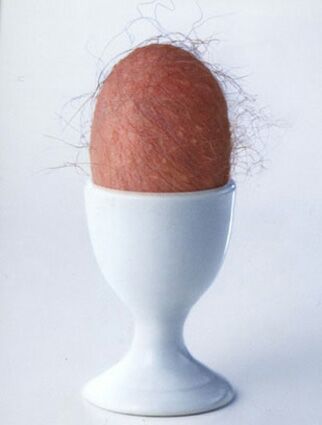 100 % Anstieg binnen 12 Monaten ab jetzt 38644