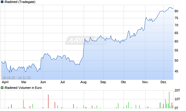 iRadimed Aktie Chart
