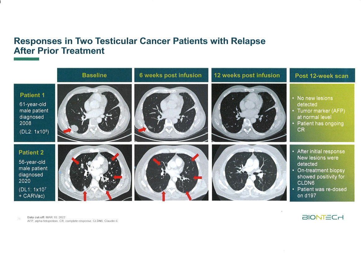 Biontech & MRNA: Revolution in der Pharmaindustrie 1392428