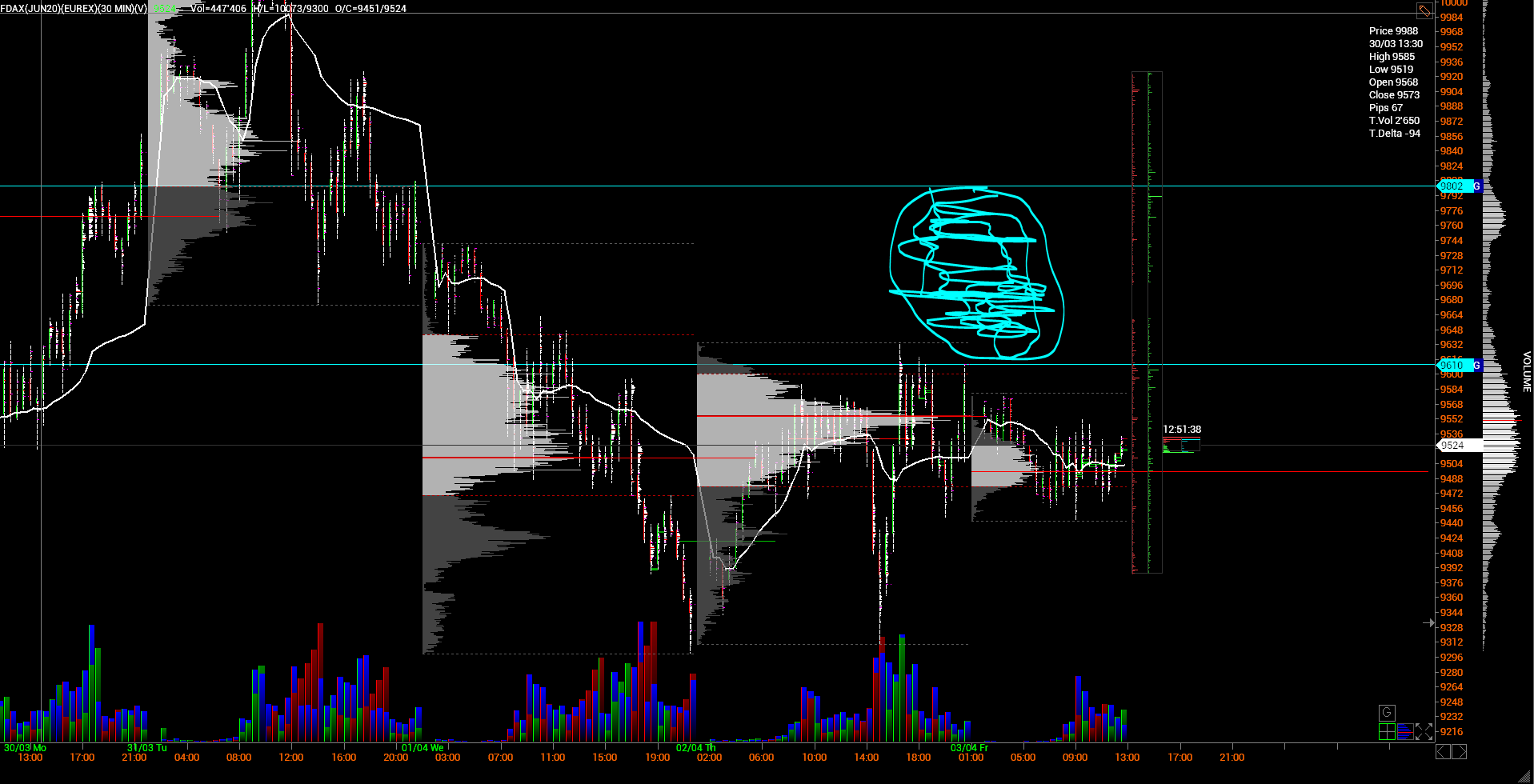 QV ultimate (unlimited) 1170555