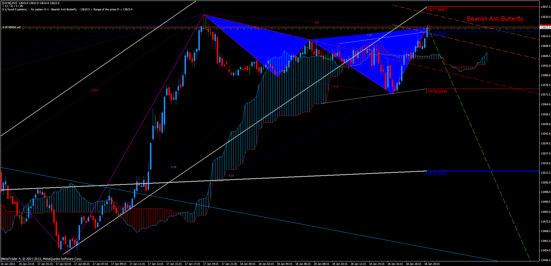 QV ultimate (unlimited) 570704