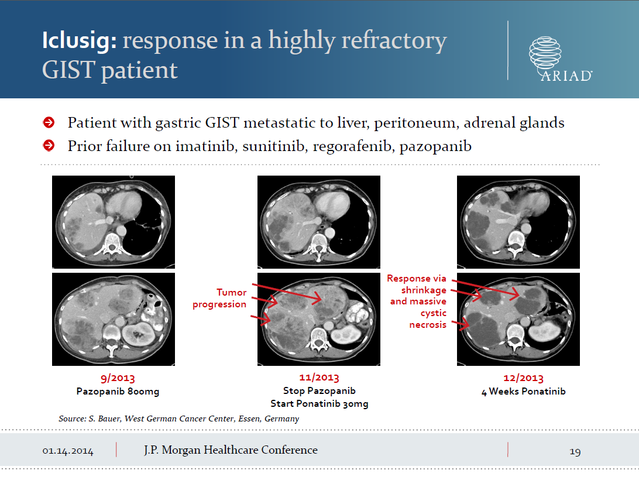 Ariad Pharma on the Top 686754
