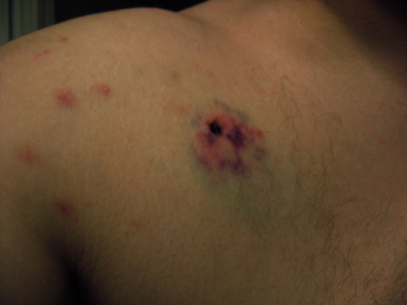 Injex AG - Wahrheit und Träumerei 569362