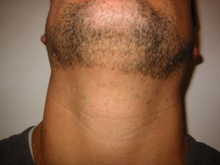 Thompson Creek Metals 77524