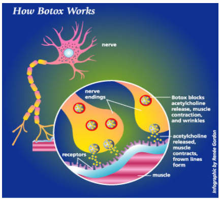 Injex AG - Wahrheit und Träumerei 524213