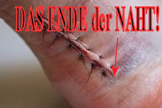 E.on SE - Chance oder Risiko 622840