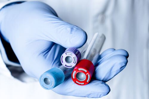 Unternehmensprofil 2Invest AG