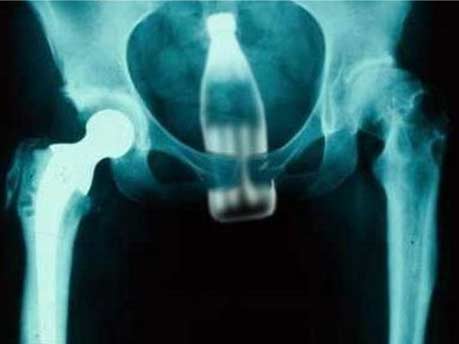 Der Antizykliker-Thread 291936