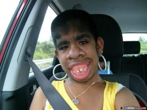 INJEX AG - Come-back zum Weltmarktführer 562418