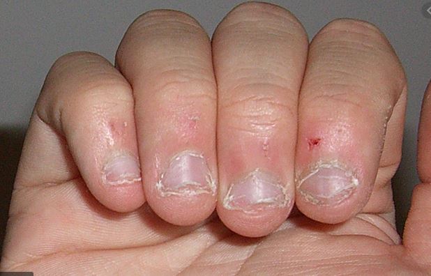 Netcents Technology Thread moderiert A2AFTK 1167280