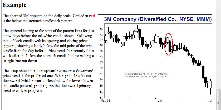 Technisches, Lustige CT-Figuren und Anekdoten 412549