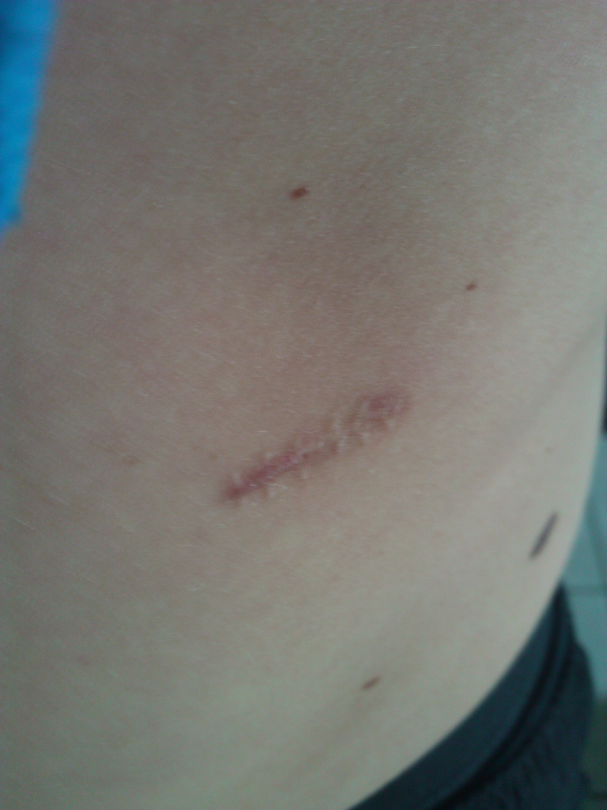 Ariad Pharma on the Top 729046