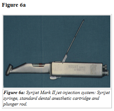 Injex AG - Wahrheit und Träumerei 498972
